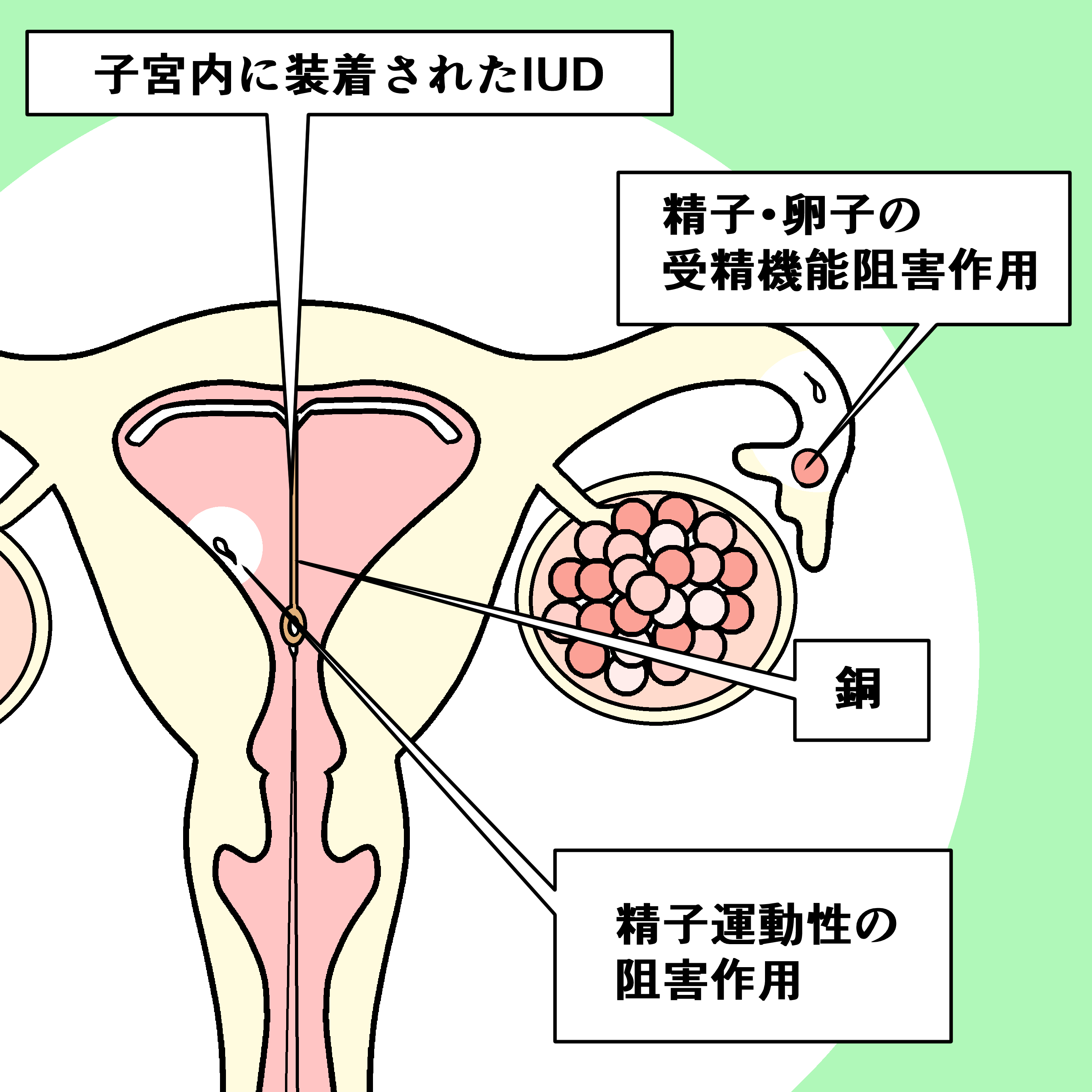 ミレーナ 中だし